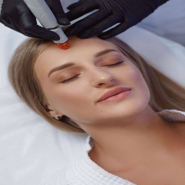hydrate your skin with hydrafacial