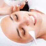 types of chemical peels